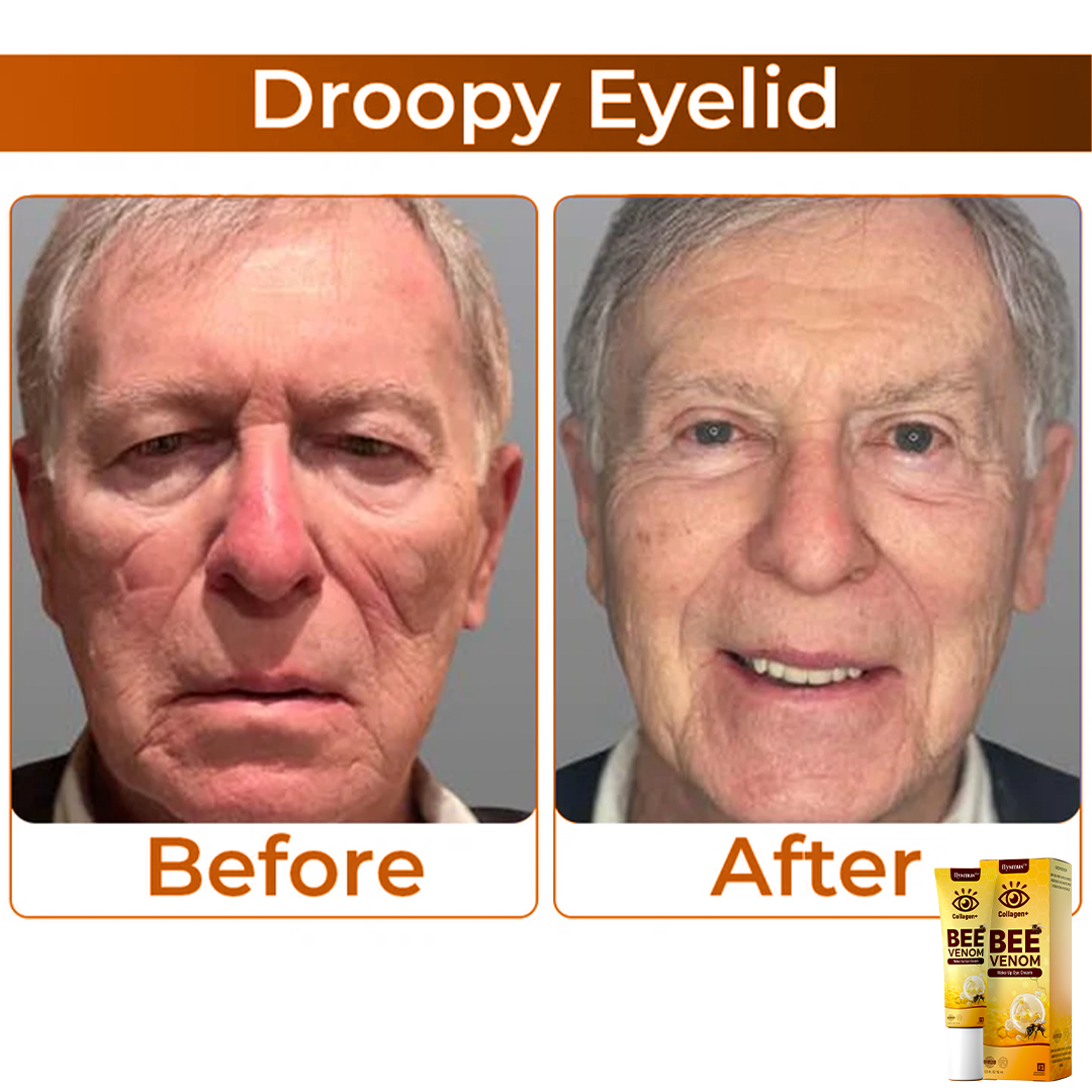 Venin de albină+Colagen : Treziți-vă privirea