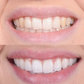 Clareamento dental rápido para um sorriso radiante 