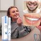 Clareamento dental rápido para um sorriso radiante 