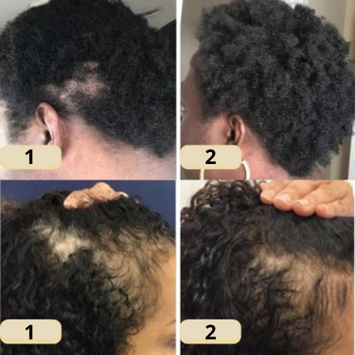 Seu óleo natural para o crescimento do cabelo 