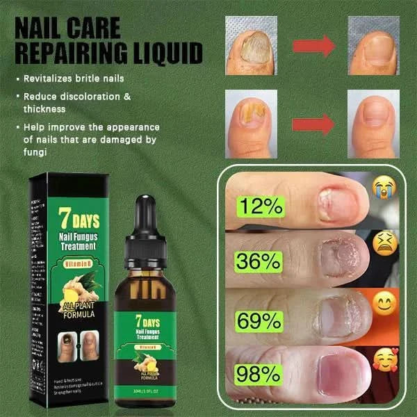 Tratamento das unhas – Cuidado antifúngico natural 