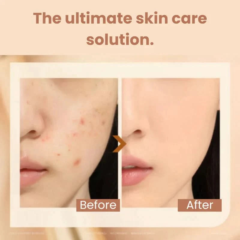 Pele perfeita e efeito anti-idade instantâneo 
