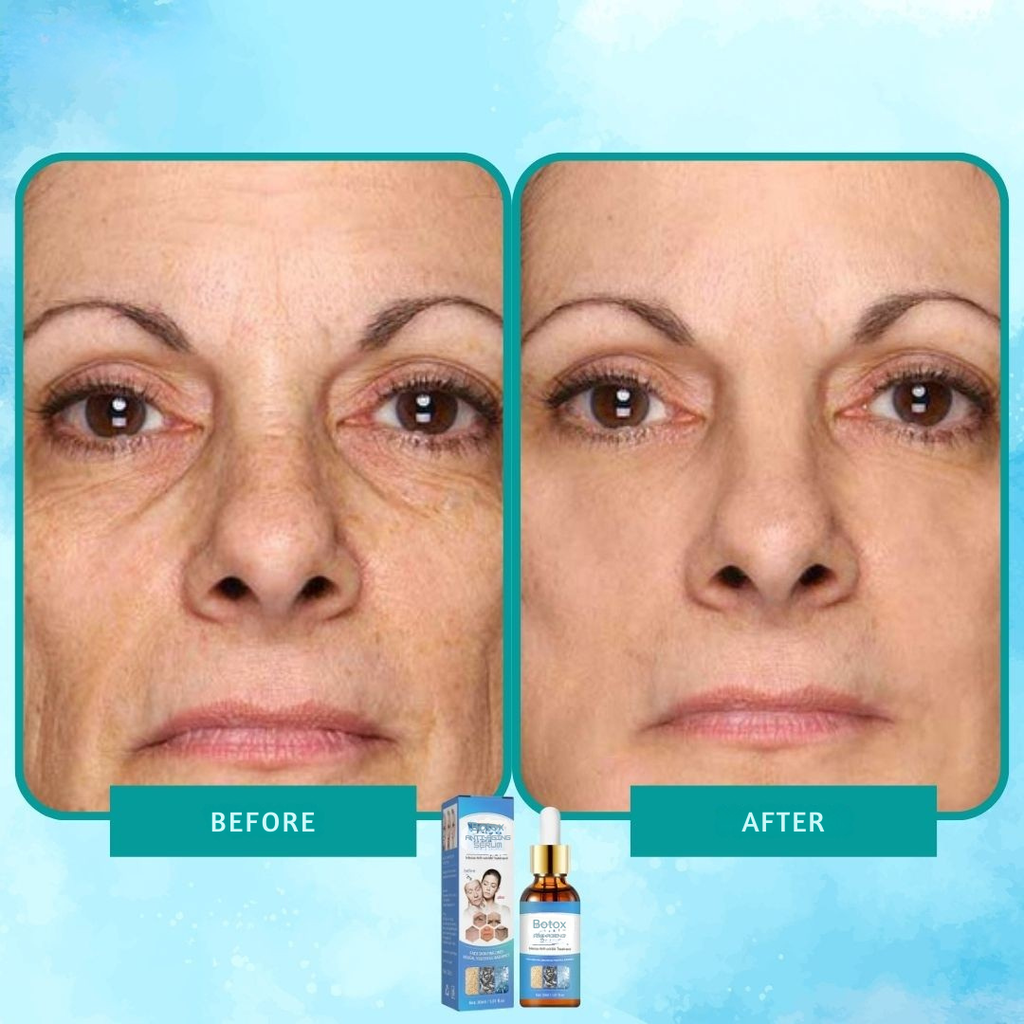 Siero botox elisir anti-rughe intenso 