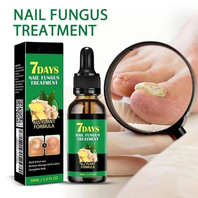 Tratamento das unhas – Cuidado antifúngico natural 