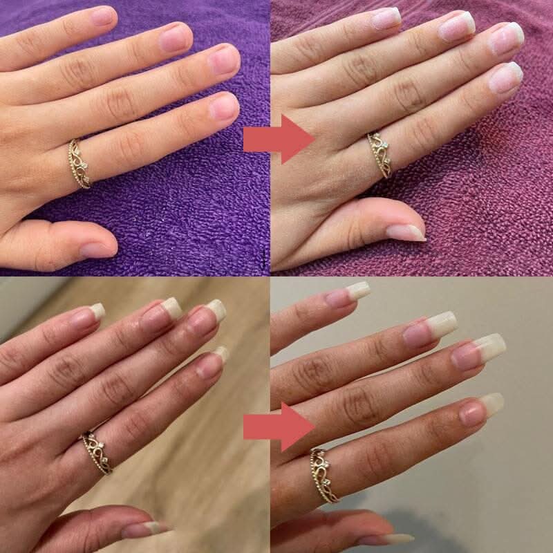 Caneta nutritiva para cutículas e unhas secas 