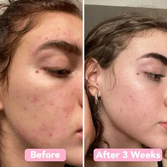 Esponja de cúrcuma – Pele limpa e purificada naturalmente (x40) 