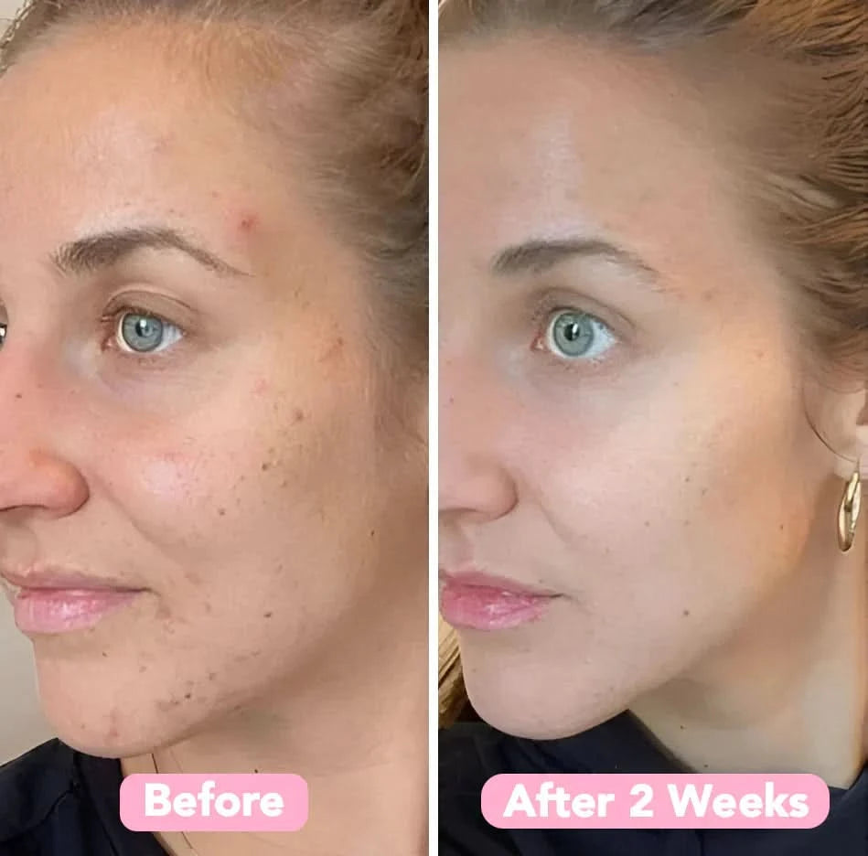 Esponja de cúrcuma – Pele limpa e purificada naturalmente (x40) 