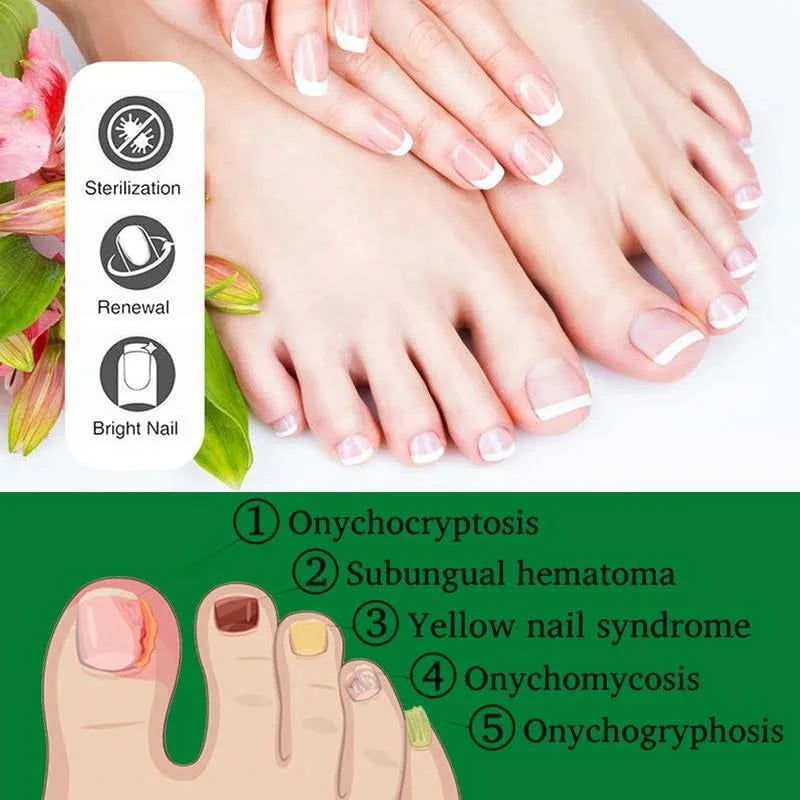 Tratamento das unhas – Cuidado antifúngico natural 