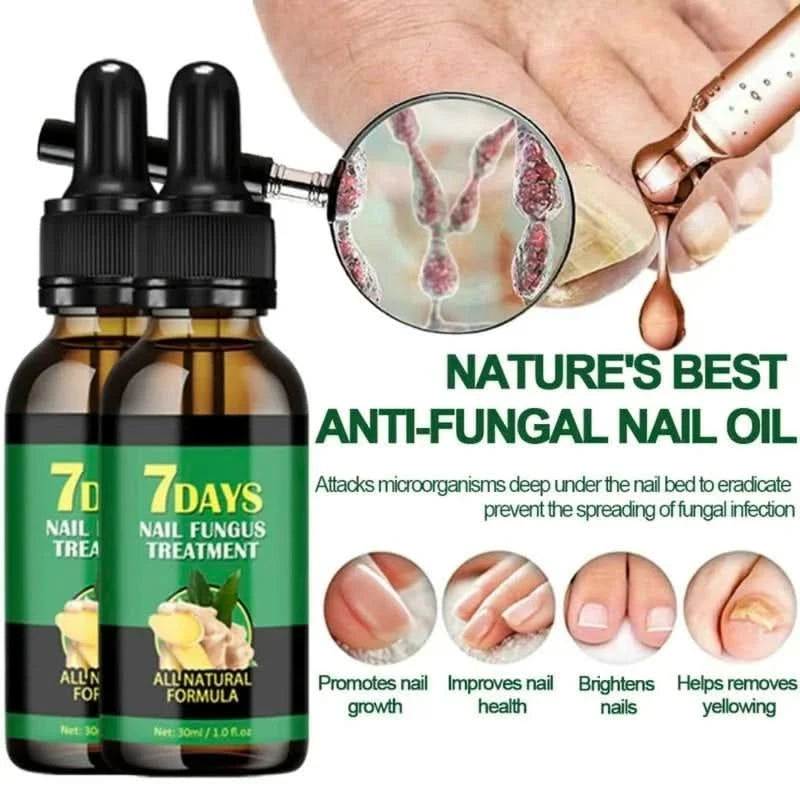 Tratamento das unhas – Cuidado antifúngico natural 